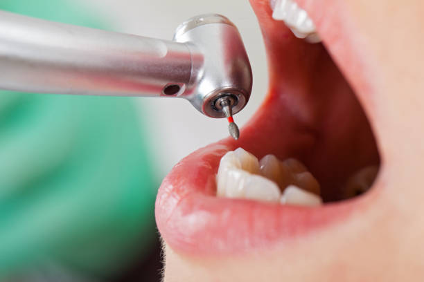 Best Walk-In Emergency Dental Services in Sweet Springs, MO